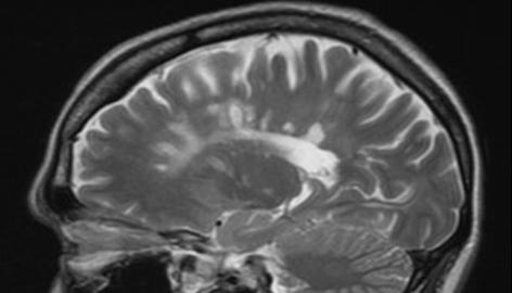 mri brain scan. Brain scans using magnetic