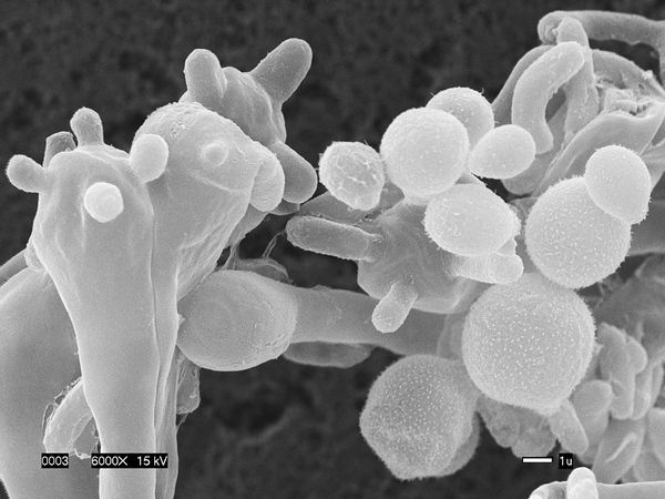 new-killer-airborne-fungus-cryptococcus-gattii