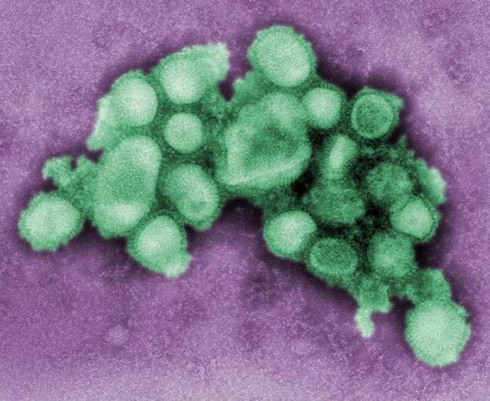US-HEALTH-SWINE FLU-VIRUS A H1N1