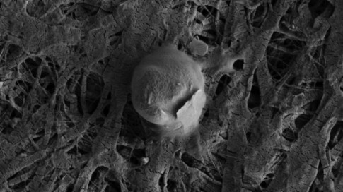 Scientists present definitive proof that life exists .5 miles beneath the ice sheet in the Antarctic lake. Pictured here, a coccoid shaped microbial cell with an attached sediment particle from the Subglacial Lake Whillans water column