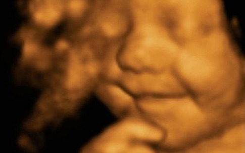 Baby captured smiling in the womb by ultrasound