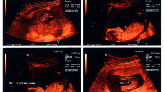 Four-Image-Ultrasound