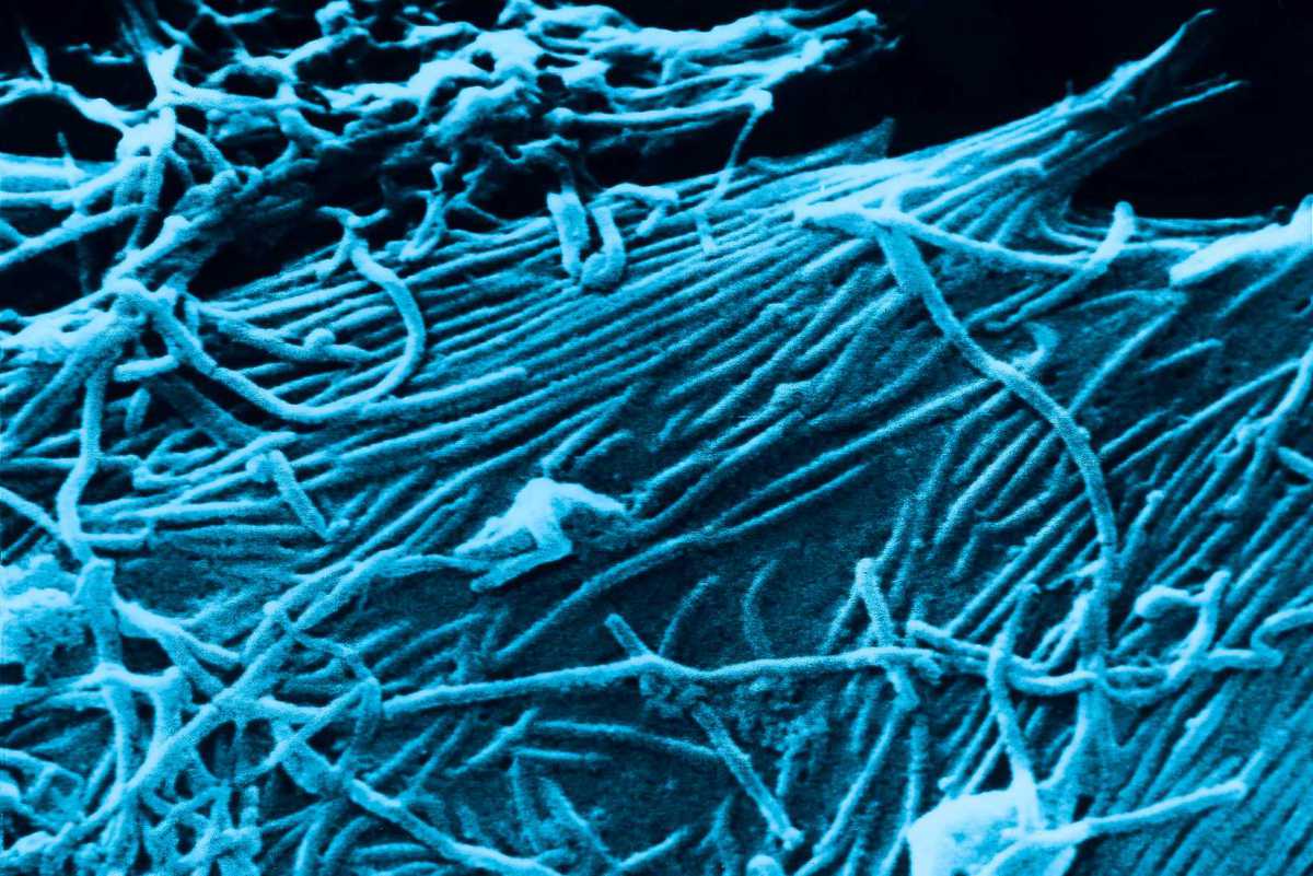 This scanning electron micrograph, SEM, depicts a number of Ebola virions