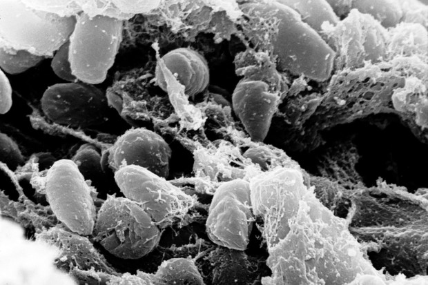 Scanning electron micrograph depicting a mass of Yersinia pestis bacteria